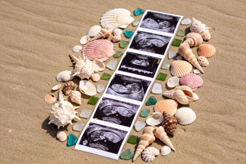 Seashells & Sonograms